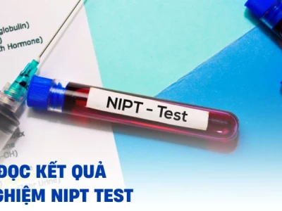 Cách đọc kết quả xét nghiệm NIPT để biết trai hay gái